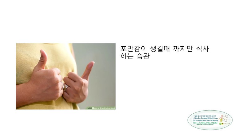 고도비만수술의 대세 위소매절제술 후 일반식하기